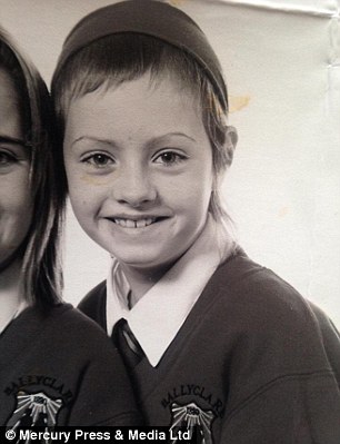 Throughout her teenage years, Eden wore a thick hairband to cover her baldness